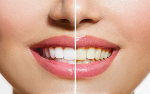 does drinking green tea stain your teeth