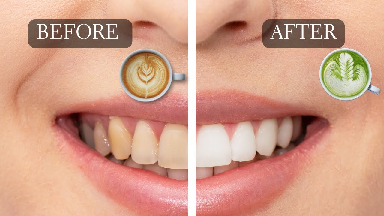 does green tea make your teeth yellow