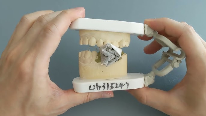 how long to bite on tea bag after extraction