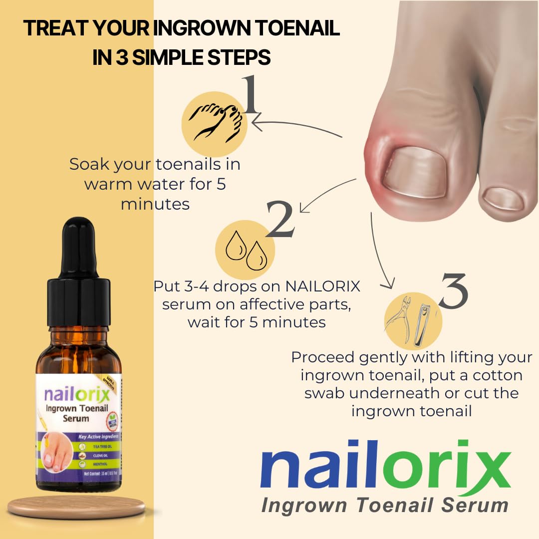 tea tree oil ingrown toenail
