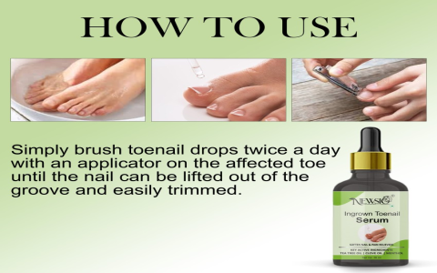 tea tree oil ingrown toenail
